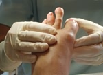 Foot Treatment Warwick
