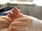 Foot Treatment Kenilworth