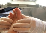 Foot Treatment Kenilworth